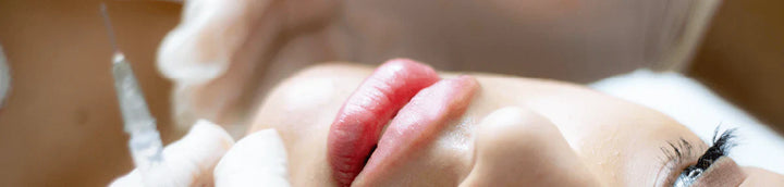 FAQ sui Filler Dermici: Risposte ai Dubbi Comuni
